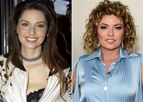 shania twain before after plastic surgery